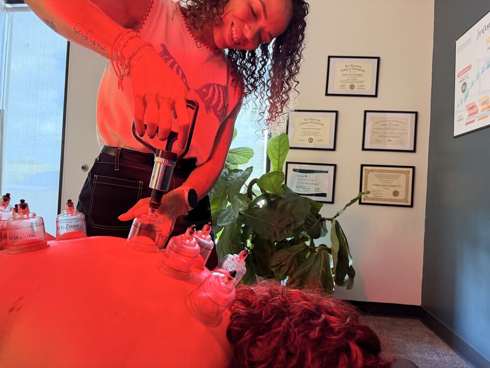 Cupping therapy at WholeCare Wellness Collective Marietta