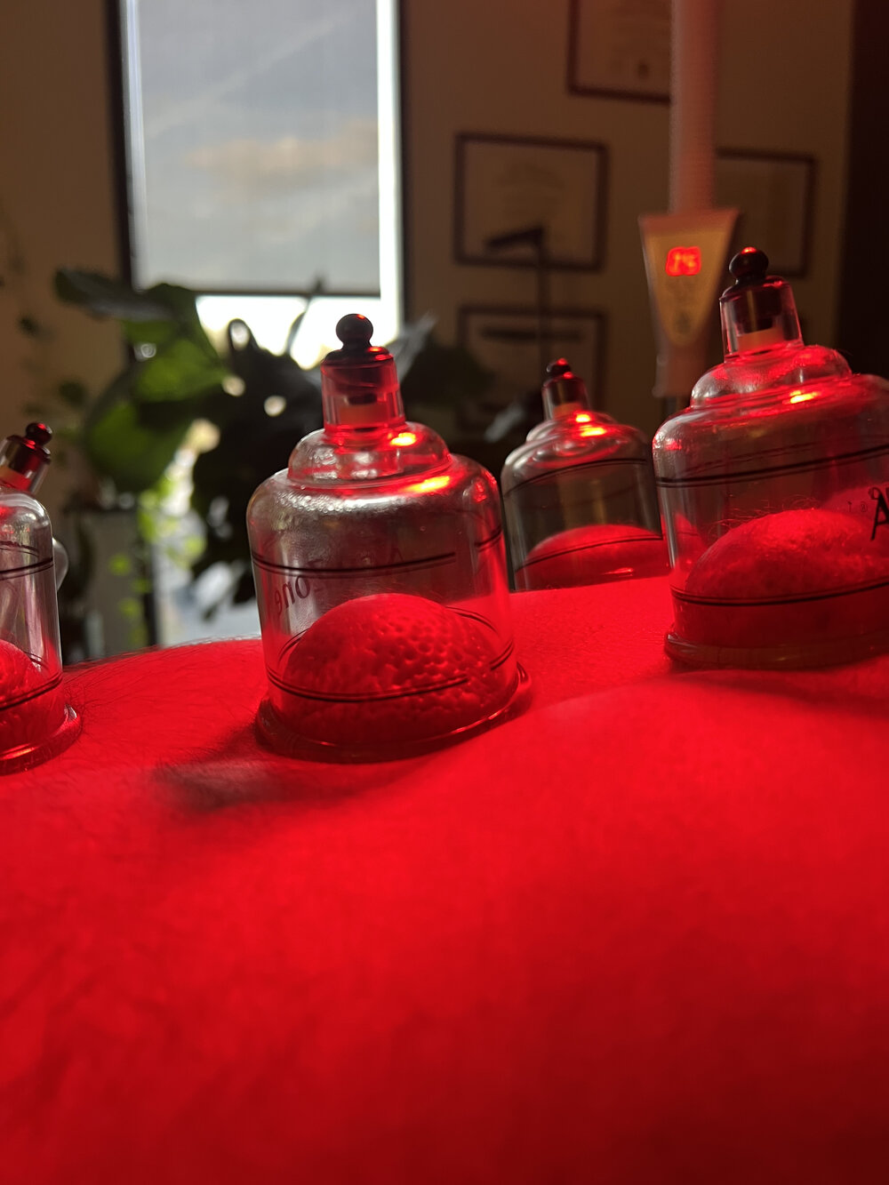 Infrared light therapy at WholeCare Wellness Collective Marietta